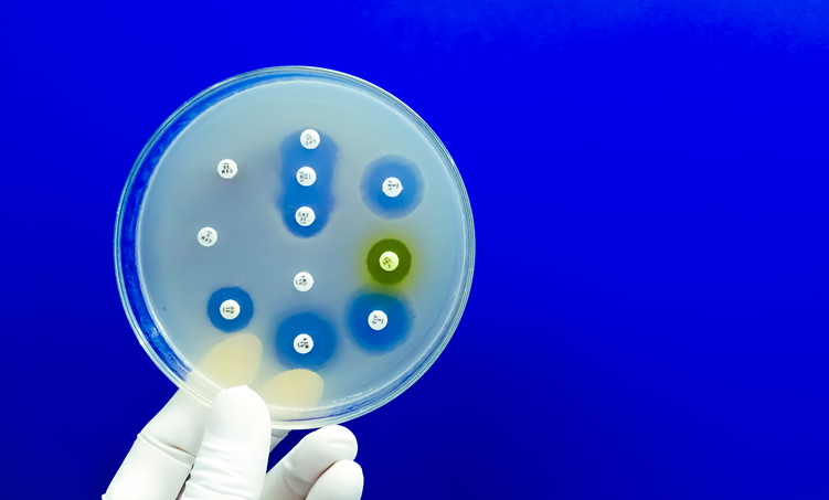 Potentie van kruiden bij antimicrobiële resistentie